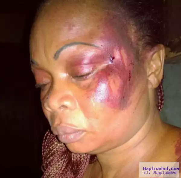 Graphic Photos: See What A Jealous Husband Did To His Wife In Lagos
